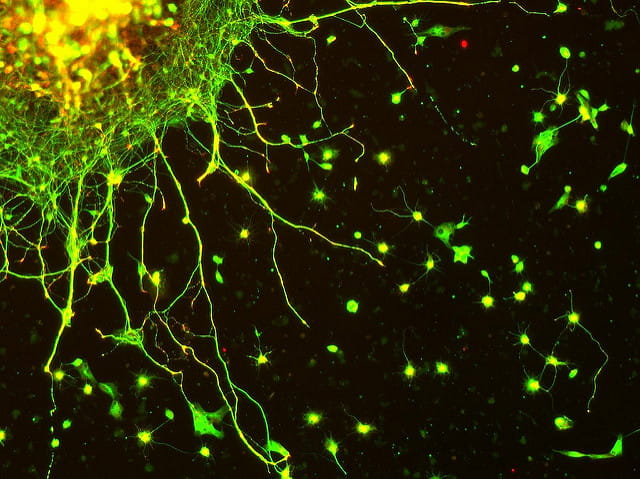 Neurone in vitro.
